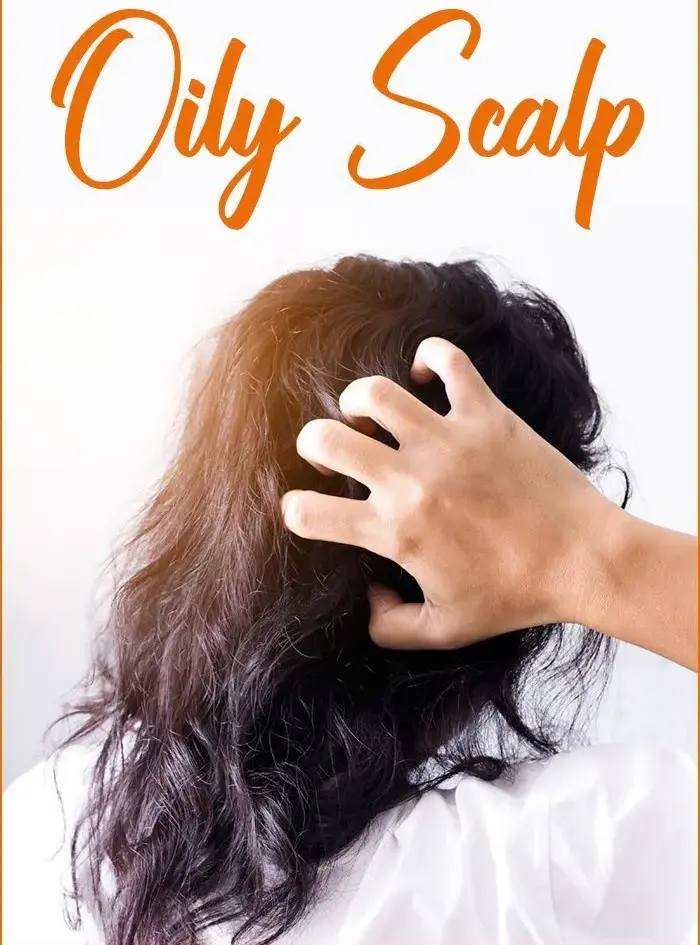 Oily Scalp